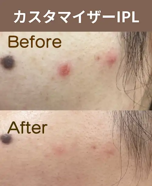 IPL機種イメージ